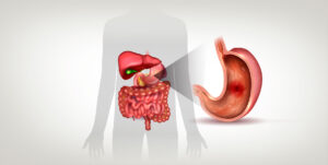 Úlcera Gástrica: O que é, sintomas, tratamentos e causas.