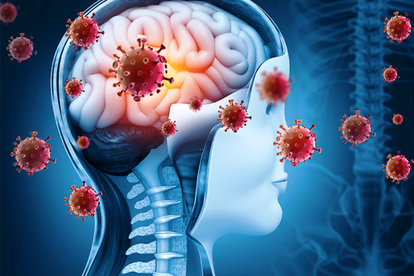 Meningite Bacteriana