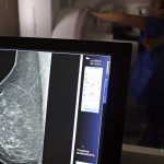 falta-de-acesso-a-mamografos-limita-prevencao-do-cancer-de-mama