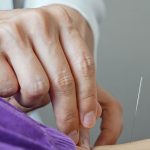 brasil-regulamenta-exercicio-profissional-da-acupuntura