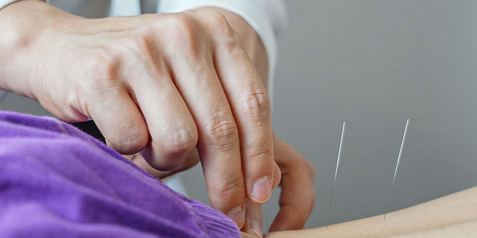 brasil-regulamenta-exercicio-profissional-da-acupuntura