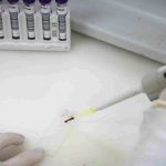 paciente-em-sp-com-suspeita-de-ebola-testa-positivo-para-meningite